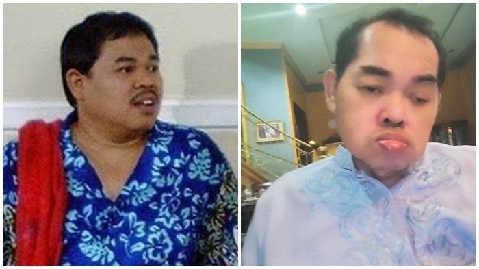 Kondisi terkini Mat Solar saat merayakan ulang tahun yang ke 60.