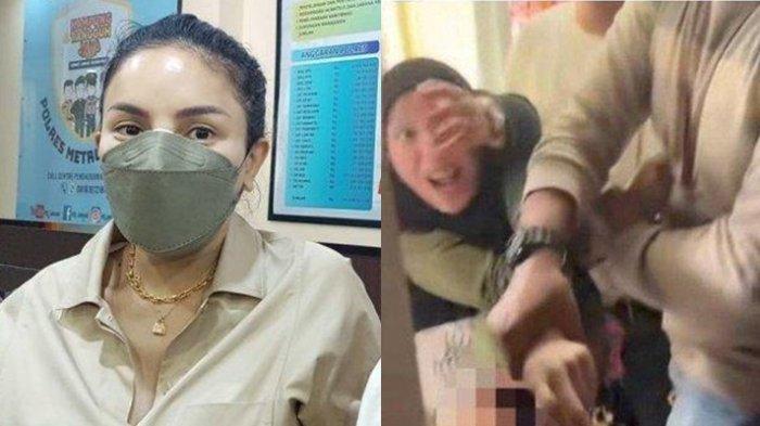 Nikita Mirzani Akui Hidungnya Ditonjok Lolly