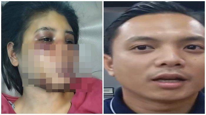 PENGANIAYAAN ART DI BATAM - Intan, Seorang ART di Batam asal Kecamatan Loli, Kabupaten Sumba Barat, Nusa Tenggara Timur (NTT) diduga menjadi korban penganiayaan oleh majikannya (kiri). Kasat Reskrim Polresta Barelang, AKP M Debby Tri Andrestian saat ditemui sejumlah awak media, Senin (23/6/2025) (kanan). Polisi masih menyelidiki motif terkait kasus penganiayaan seorang ART asal Kecamatan Loli, Kabupaten Sumba Barat, Provinsi NTT di Perumahan Sukajadi hingga viral di medsos.