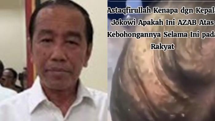 Penampakan kulit kepala Jokowi