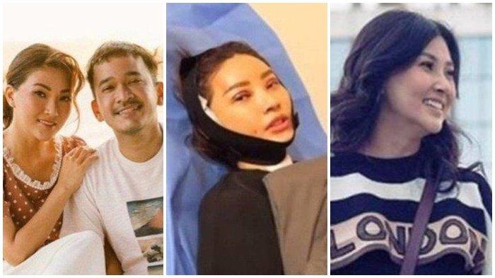 Penyebab Sarwendah nekat operasi plastik usai digugat cerai Ruben Onsu terungkap.