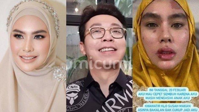Richard Lee sentil Kartika Putri dan siap obati penyakit istri Habib Usman kembali cantik lagi.