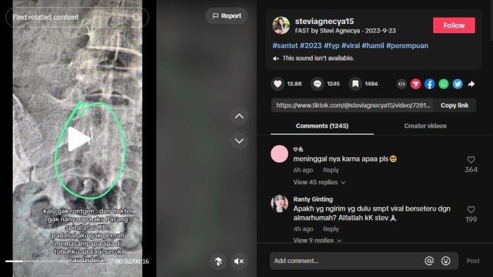 Stevie Agnecya sempat memperlihatkan hasil rontgen tubuhnya.