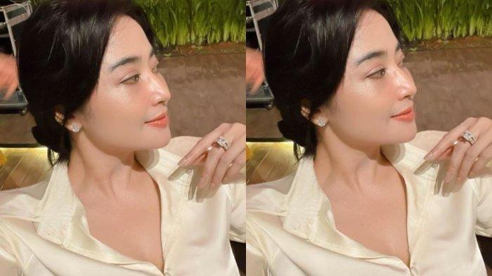 Takut Membusuk, Alasan Dewi Perssik Tolak Oplas Bagian Wajah Meski Dibayar Rp1 M, Ucap Amit-amit