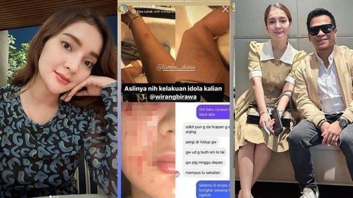 Umi Kalsum, istri paranormal Wirang Birawa mendadak klarifikasi usai sempat menghebohkan publik karena postingannya diduga jadi korban KDRT suami.