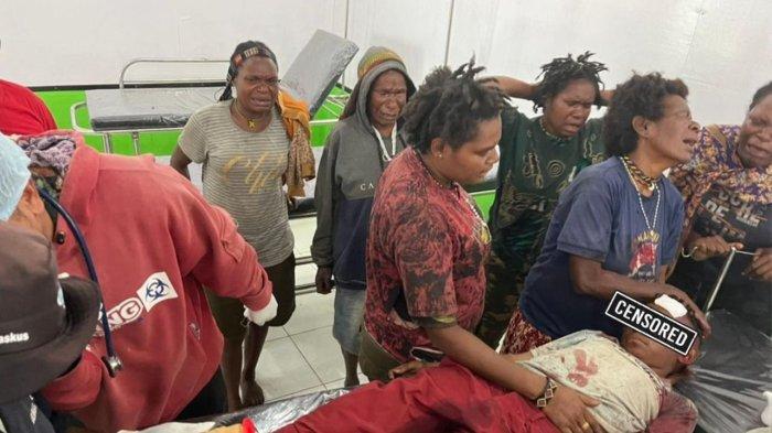 Tampak salah satu bocah yang menjadi korban penembakan KKB di Intan Jaya saat dievakuasi di rumah sakit.