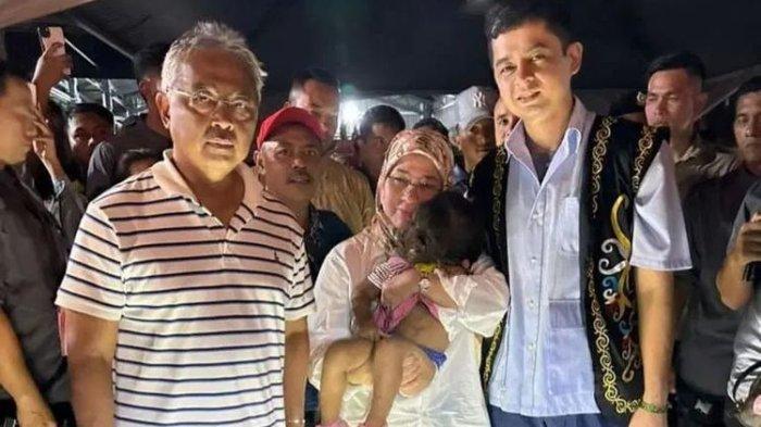 Ratu Malaysia Tunku Azizah Aminah Maimunah Iskandariah saat bertemu Missclyen Roland (2) di Sarawak pada September 2023. Sang Ratu kemudian mengadopsi anak dengan hipertrikosis atau sindrom manusia serigala tersebut.
