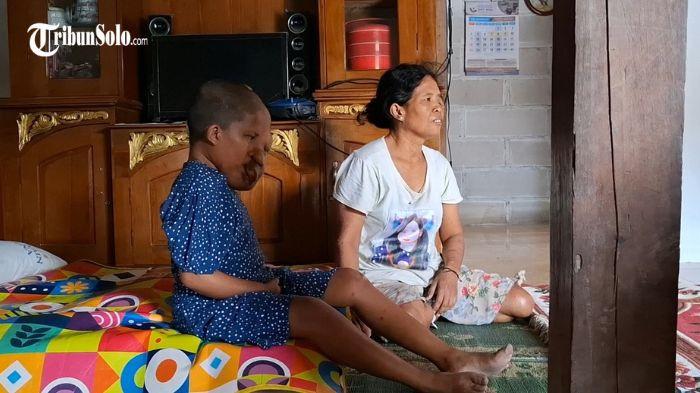 DERITA TUMOR - Poniyem (47) dan putri kecilnya, Cahaya (12), saat ditemui Selasa (29/7/2025). Warga Sambungmacam Sragen tersebut tengah melawan penyakit tumor, yang tumbuh di wajah dan tangan mereka.