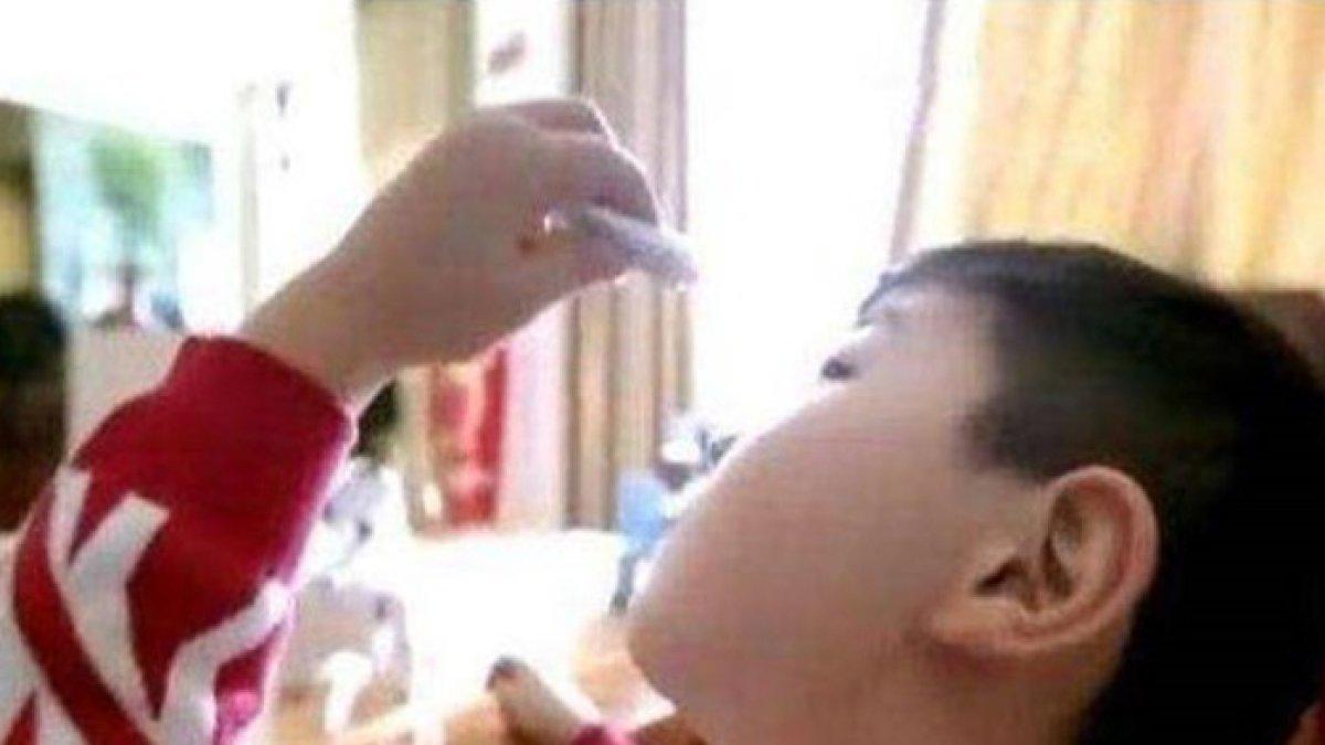 Ilustrasi mata anak kena lem