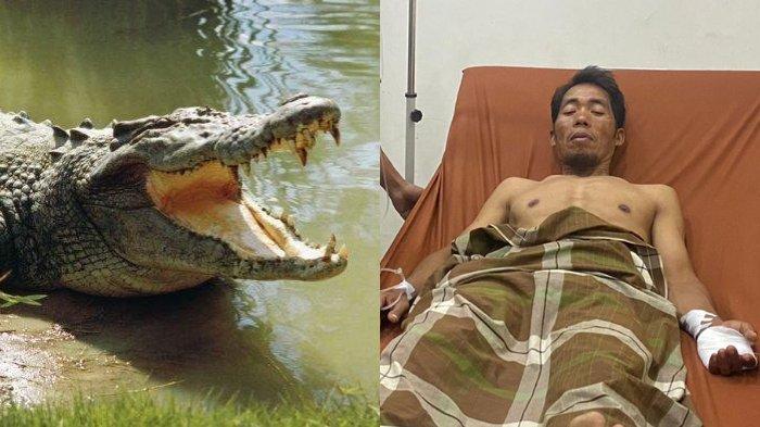 Abdul Rajab (41) warga Desa Tampalang, Kecamatan Tapalang, Kabupaten Mamuju, Sulawesi Barat (Sulbar), dirawat di Puskesmas setelah mengalami luka serius akibat serangan buaya, Jumat (24/5/2024).