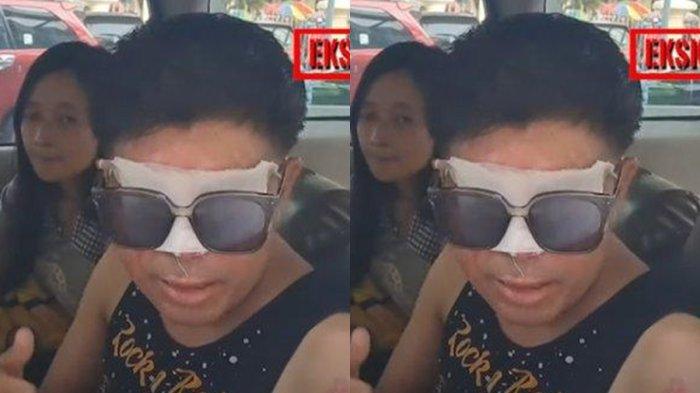 Agus korban penyiraman air keras ini hanya berharap warganet stop menghujatya dan keluarga.