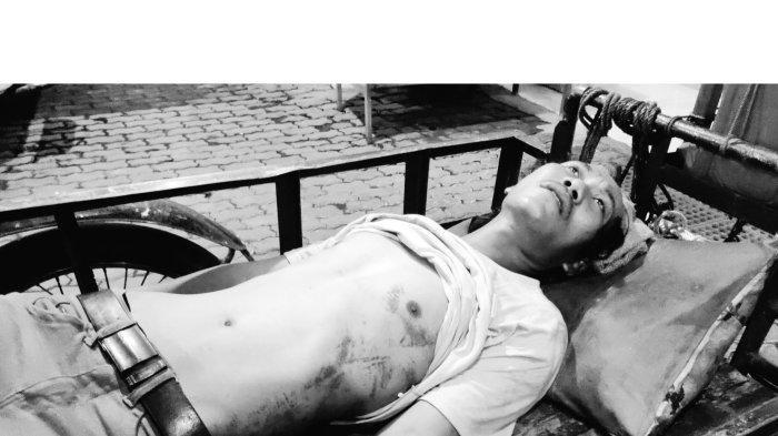 Ahmad Firdaus (37), pengatur lalu lintas ilegal atau 'Pak Ogah' di Jalan Sisingamangaraja mengaku digebuki Polisi usai ditangkap di Jalan Sisingamangaraja Medan, diantara hotel Grand Antares dan Universitas Budi Dharma, Sabtu (21/10/2023) sekira pukul 18:00 WIB.