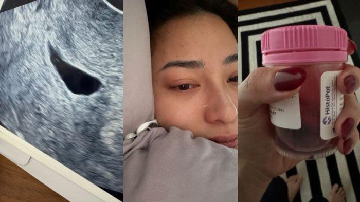 Curhat Pilu Nikita Willy Keguguran Calon Anak Kedua, Tegar Dapat Dukungan Manis dari Indra Priawan