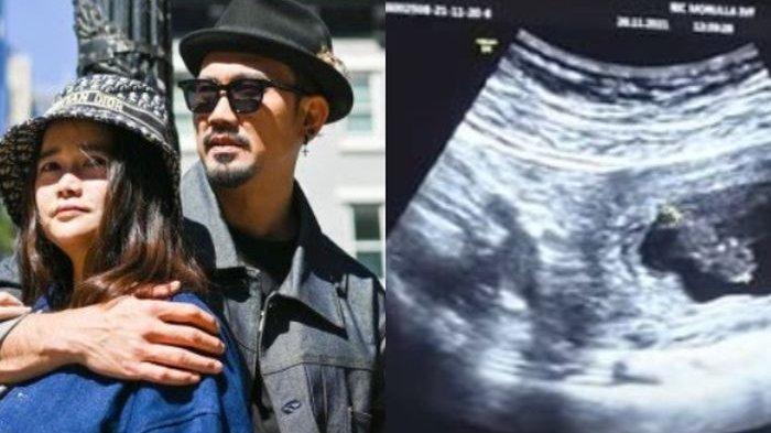 Denny Sumargo dan Olivia Allen
