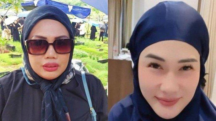 Elly Sugigi Kuak Almarhumah Stevie Agnecya Sempat Alami Pendarahan Sebelum Meninggal Dunia