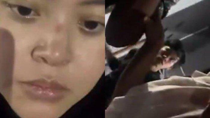 VIRAL MAS PELAYARAN: Inilah sosok wanita bernama Tyas yang diduga dianiaya keluarga mas pelayaran hingga bikin ratusan driver ojol mengamuk. Kondisinya miris alami luka lebam hingga bekas cakaran.