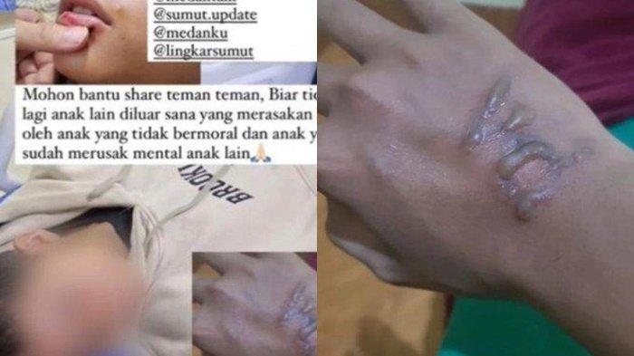 Kronologi siswa MAN 1 Medan dianiaya kakak kelas berawal diculik 7 jam hingga dianiaya.