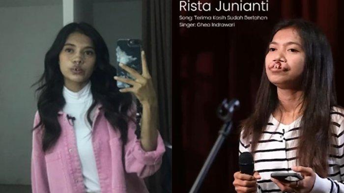 Masih ingat Rista Juniati, gadis yang pernah viral bersuara merdu, kini penampilannya berubah drastis.