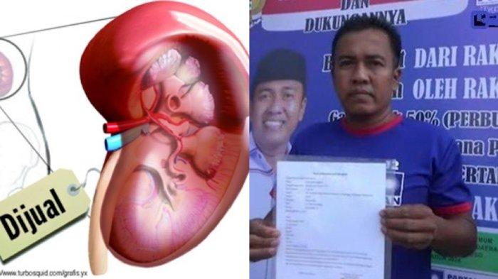 Mengenal Erfin Dewi Sudanto, Caleg Rela Jual Ginjal Demi Bisa Duduk di Kursi Parlemen