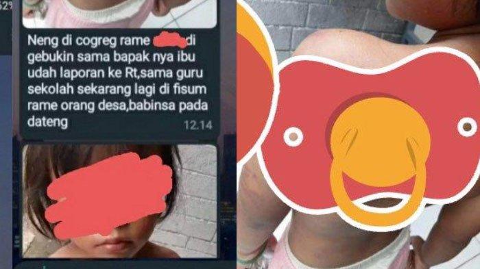 N bocah dipaksa mengamen oleh ayah hingga malam hari dan disiksa jika uang setoran ke ibu tirinya kurang