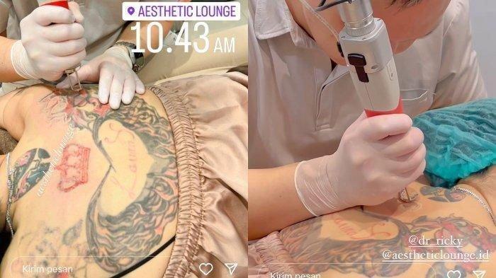 Nikita Mirzani kini tegas memutuskan menghapus tato nama Laura Meizani atau Lolly