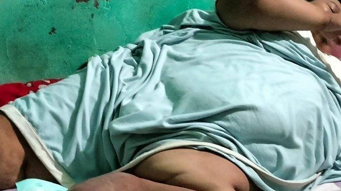 Penampakan pria obesitas bernama Engky