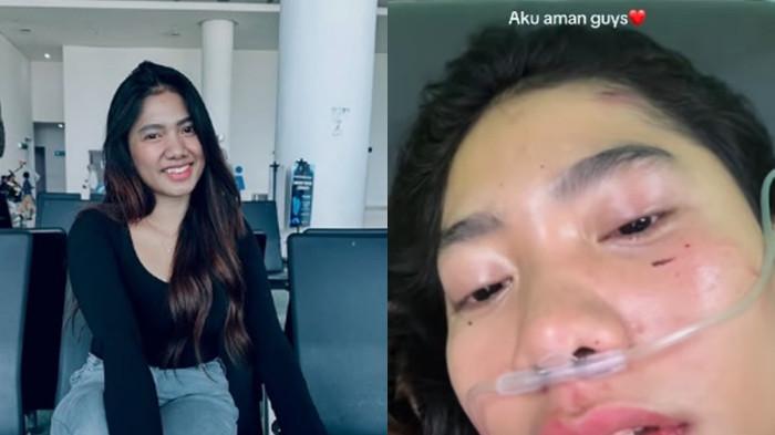 LUSYANA KECELAKAAN - Penyanyi dangdut Lusyana Jelita, mengalami kecelakaan tunggal di Tol Sragen, Jawa Tengah, pada Jumat pagi (16/7/2025).