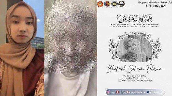 Penyebab Zhafira Zarim Febrina Korban Erupsi Marapi Meninggal Dunia,Pilu Derita Luka Bakar 70 Persen
