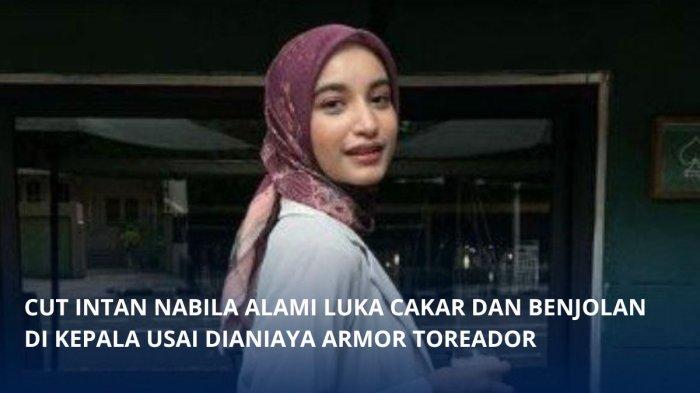 Selebgram Cut Intan Nabila alami luka dan benjolan di kepala usai dianiaya Armor Toreador.