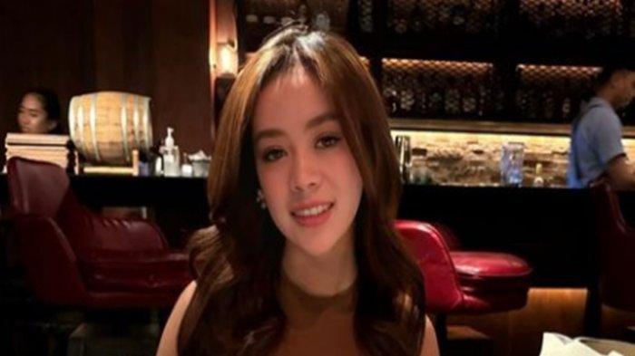 Selebgram Lampung, Anastasia Noor Widiastuti alami kekerasan dalam rumah tangga (KDRT) oleh mantan suaminya, AP.