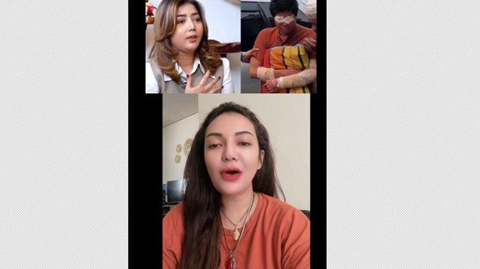 Tengku Zanzabella turut menanggapi terkait polemik dana donasi yang melibatkan Pratiwi Noviyanthi dan Agus Salim, korban penyiraman air keras.