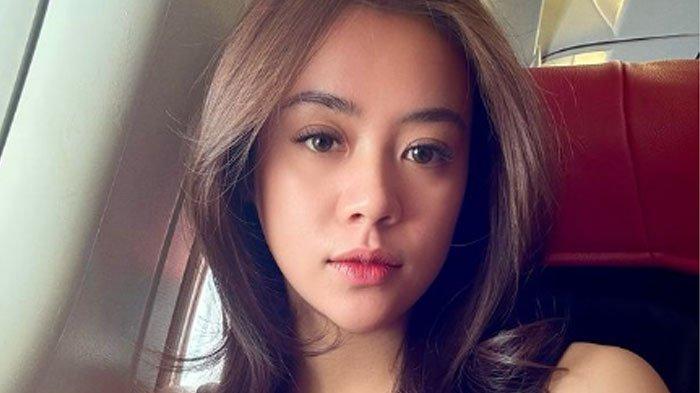 Viral Selebgram Anastasia Noor Widiastuti Alami KDRT Oleh Mantan Suami, Dianiaya Saat Temui Anak
