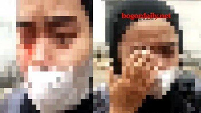 pria di Bogor yang menganiaya pacarnya hingga pelipis sang wanita berdarah karena cemburu