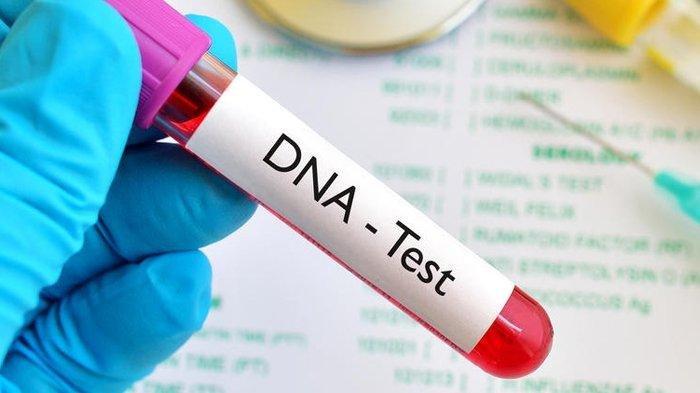 Ilustrasi tes DNA.
