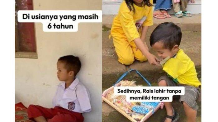 Rais, bocah SD terlahir tanpa tangan