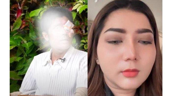 Pratiwi Noviyanthi (kanan) yang kecewa pada Agus, korban penyiraman air keras (kiri)