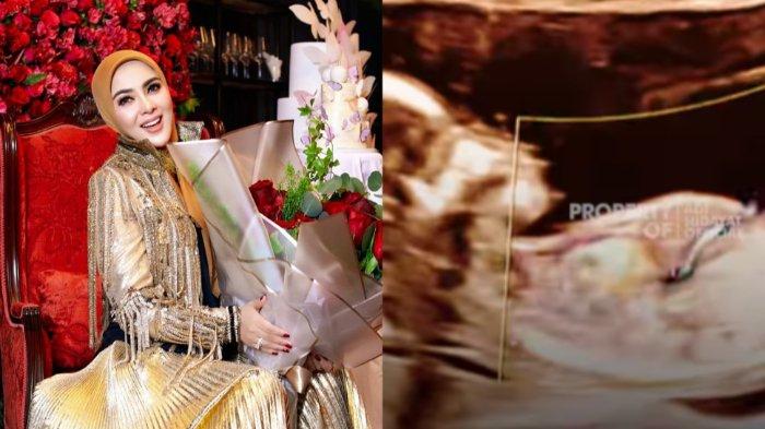 Story Instagram foto USG Syahrini disorot