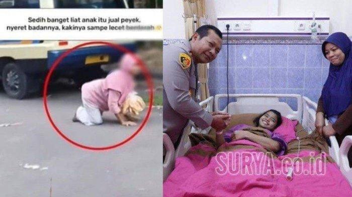 Akhir Bahagia Cyntya Anak yang Viral Jualan Peyek Sambil Merangkak, Ada Harapan Bisa Jalan Normal