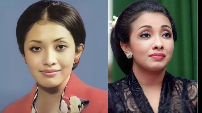 Anita Rachman penyiar TVRI Dunia Dalam Berita sakit semasa muda