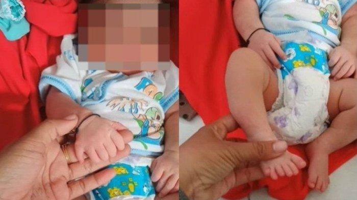 Bayi perempuan di Sampang, Madura punya 6 jari di masing-masing tangan dan kakinya