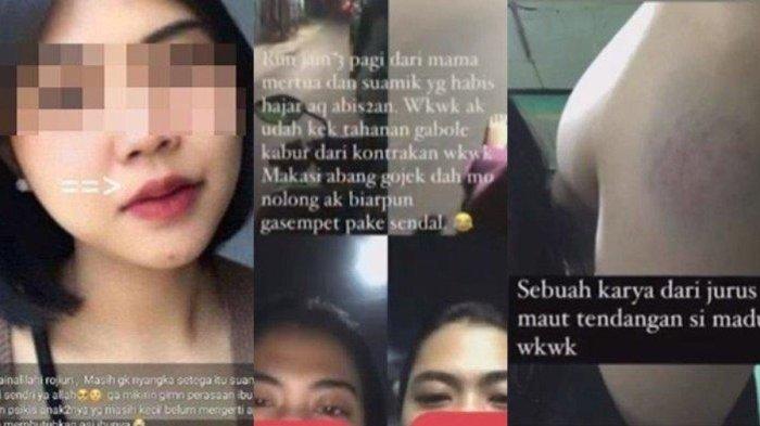Bukti kekerasan yang dialami Mega selama mendapat KDRT dari suaminya