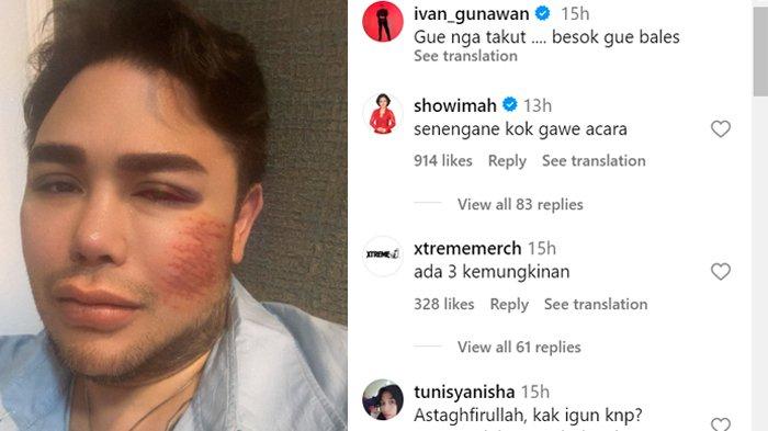 Caption foto wajah Ivan Gunawan babak belur