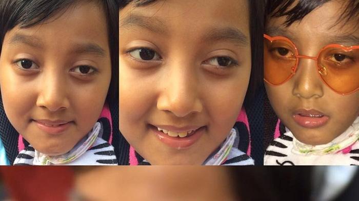 Cerita Anak Komeng Meninggal Usia 10 Tahun Karena Tersedak Mi, Meninggal di Pangkuan Sang Kakak