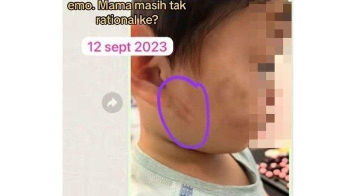 Diantara bekas cakaran di wajah