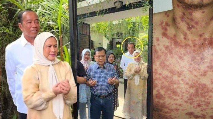 WAJAH JOKOWI - Potret wajah Jokowi saat ulang tahun ke-64 disorot lantaran terlihat beda. Warga doakan agar cepat sembuh.