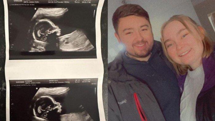 Jessica Smith sedang hamil anak pertama
