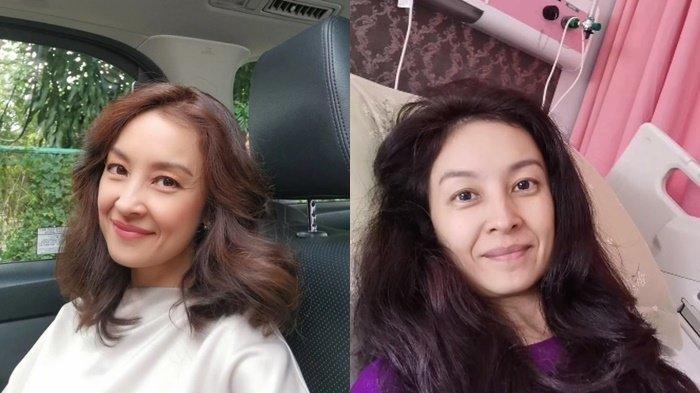 Kisah Putri Patricia Artis Sinetron Populer Tahun 90an Kini Sakit, Lakukan Operasi Benjolan di Tubuh