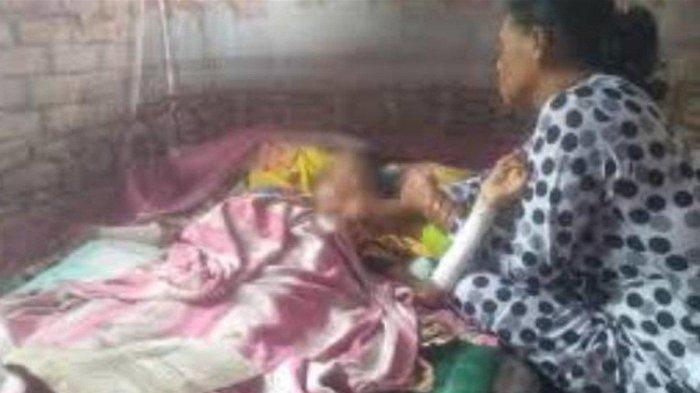 Kondisi Aldelia Rahma bocah SD dibakar teman hingga tewas 1