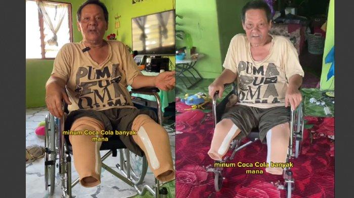 Kondisi kaki Pakcik Solih dulu ketagihan minuman bersoda kini diamputasi