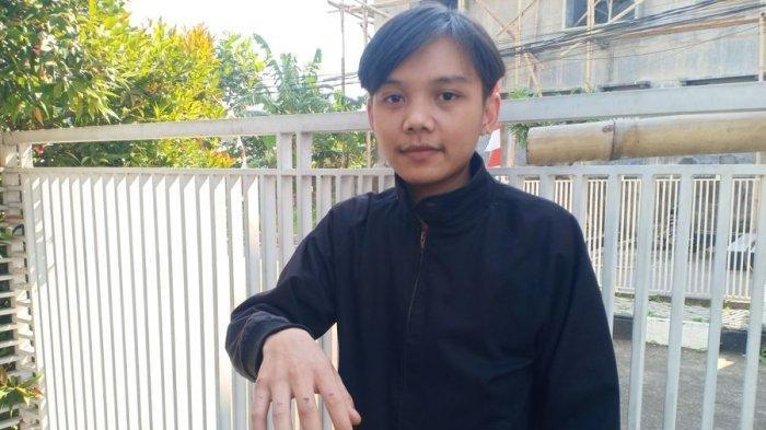 Mohamad Fadlin Auzini korban yang melawan dua begal di Cibaduyut Kota Bandung